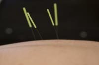 Groundswell Acupuncture image 8